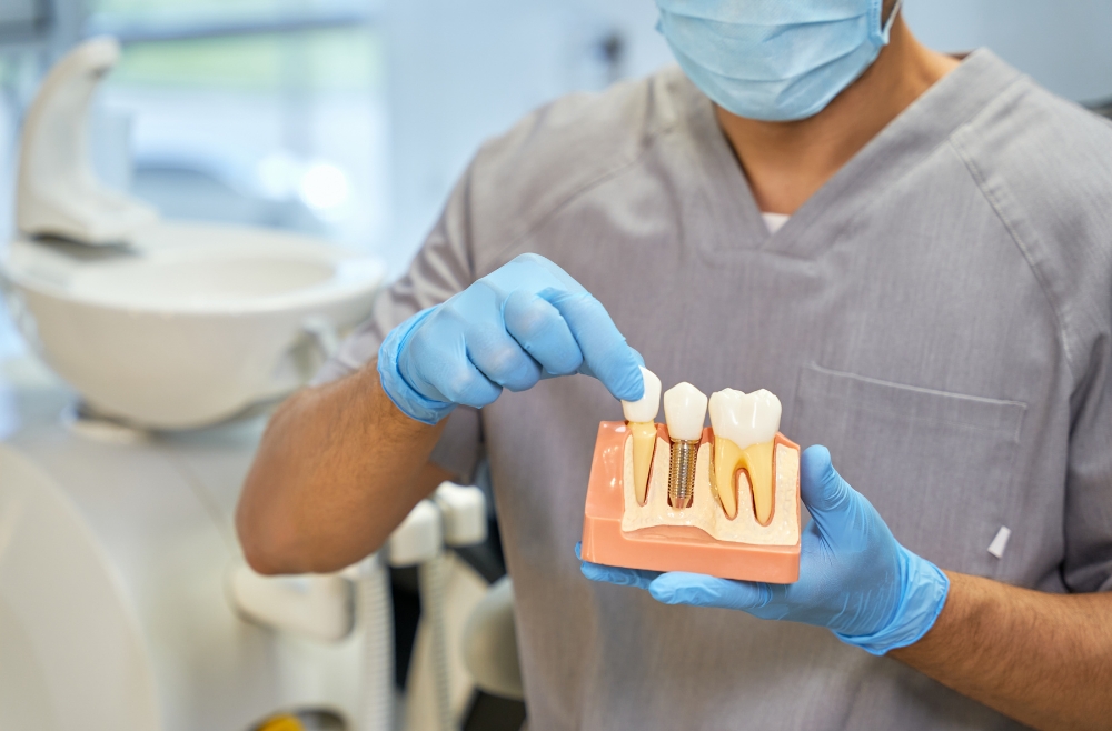 Implantes dentales en Gijón